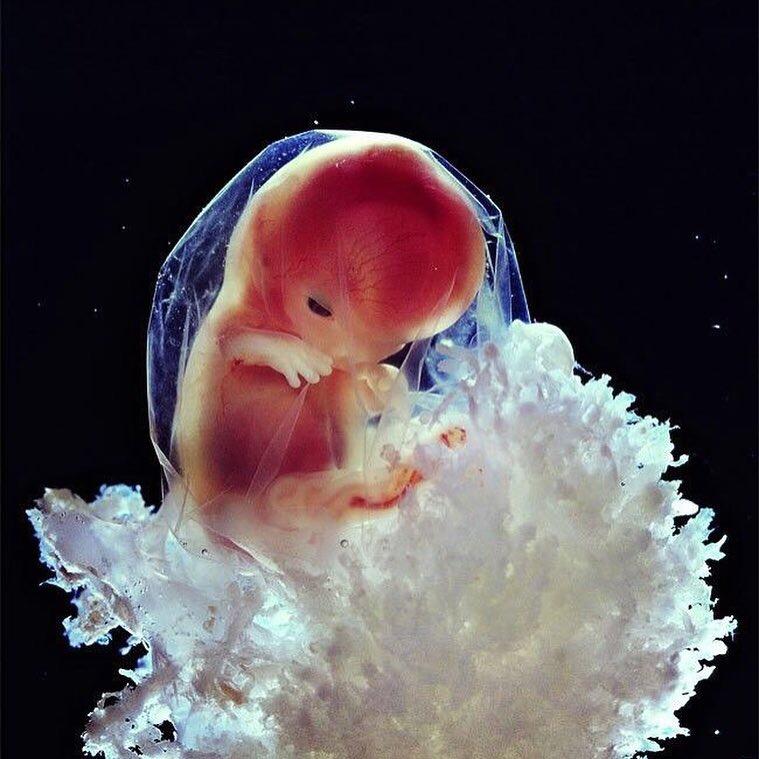 這個是Lennart Nilsson的作品，他拍攝出了曾經被認為無法拍攝的嬰兒胚胎