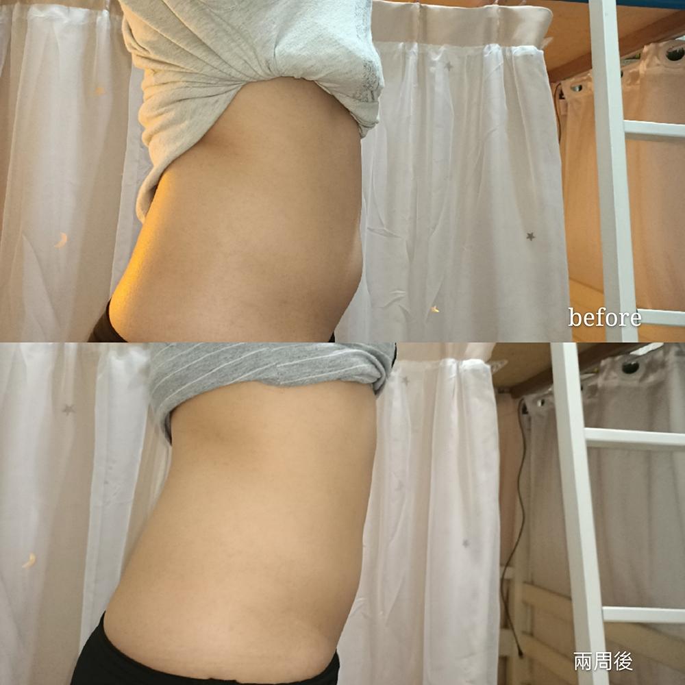 我覺得比較大的差別在於下腹有變小，然後腰後方的皺褶也沒那麼明顯。